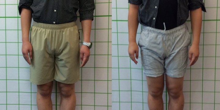 男性のO脚もあきらめないで！！