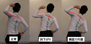 肘下がりの連鎖