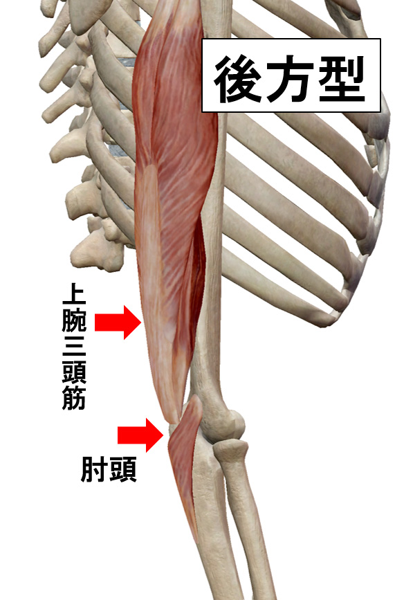 外側型