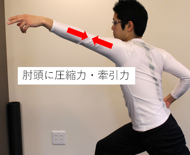外側型