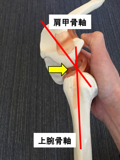 インターナルインピンジメント