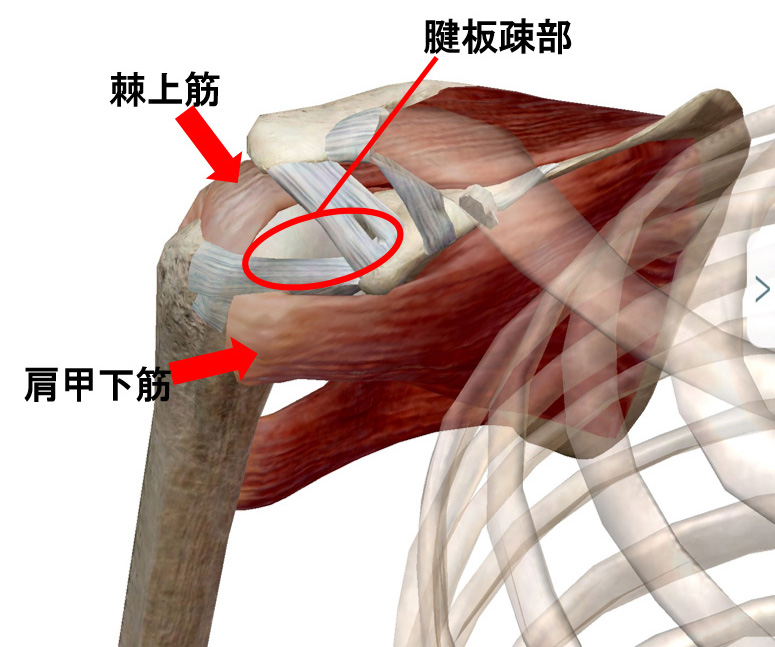 腱板疎部損傷
