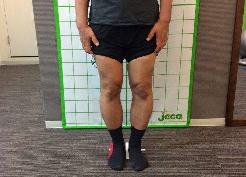 男性だから、歳だからとO脚をあきらめていませんか？男性でもO脚は改善しますよ！
