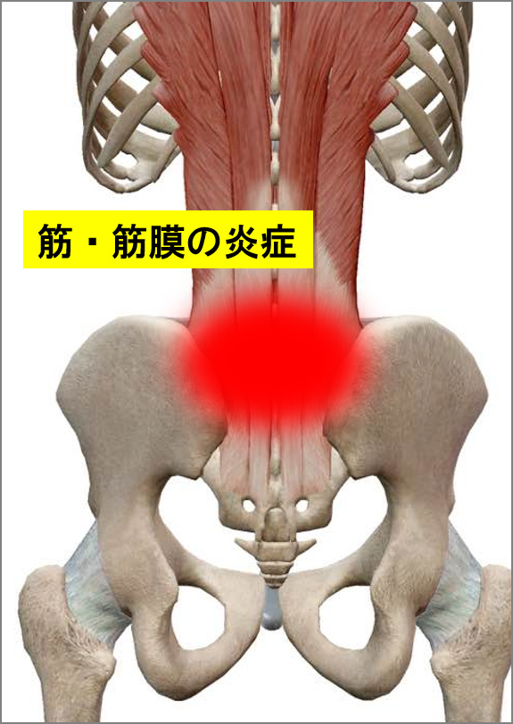 筋肉・筋膜