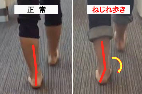 悪い歩き方