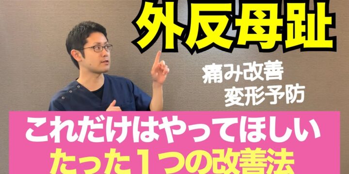 外反母趾を改善するためにまずやるべき対処法