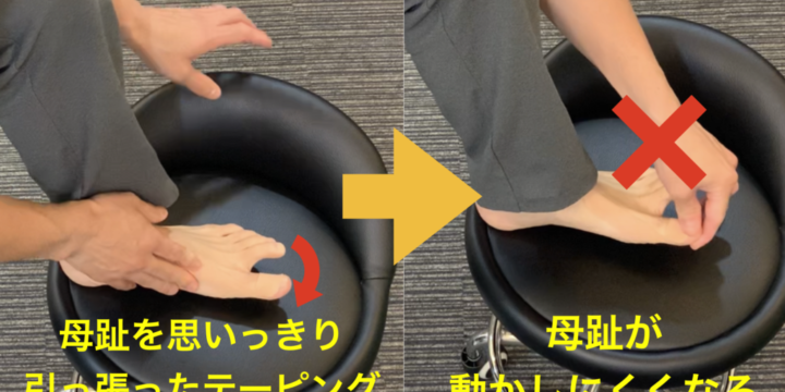 外販母趾のテーピングを巻くときに気をつけてほしい「失敗しない」ポイント
