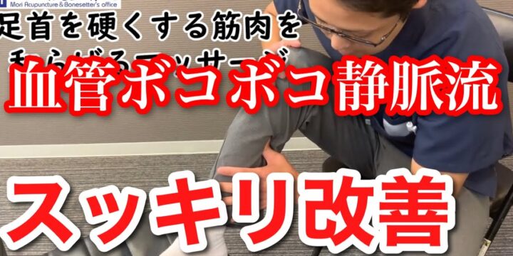 下肢静脈瘤のボコボコ血管を自分で治して足の疲れを取る方法