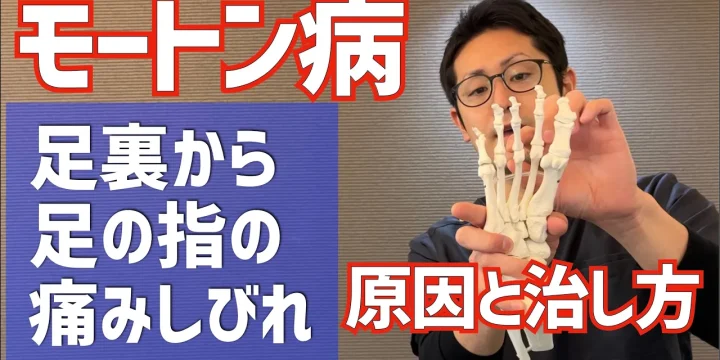 足裏、足指がしびれ痛いモートン病の原因と治療のポイント