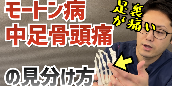 モートン病と中足骨頭痛の違いとは（足裏の前側の痛み）