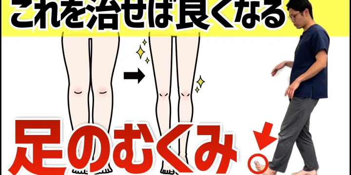 【浮指が原因だった】足のむくみを本気で解消する方法