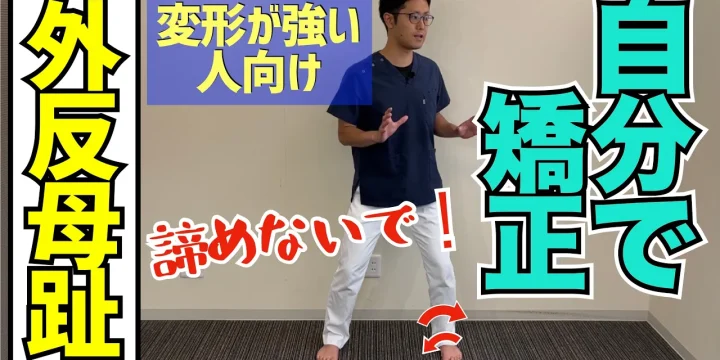 【変形強い人向け】外反母趾を自分で治す後足部回外ストレッチ