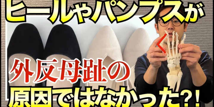 ヒールやパンプスではなかった！外反母趾の本当の原因とは　
