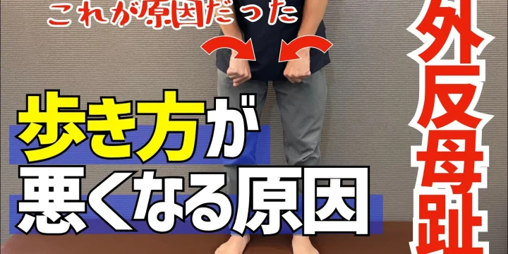 外反母趾にお悩みの方の歩き方が良くならない本当の理由