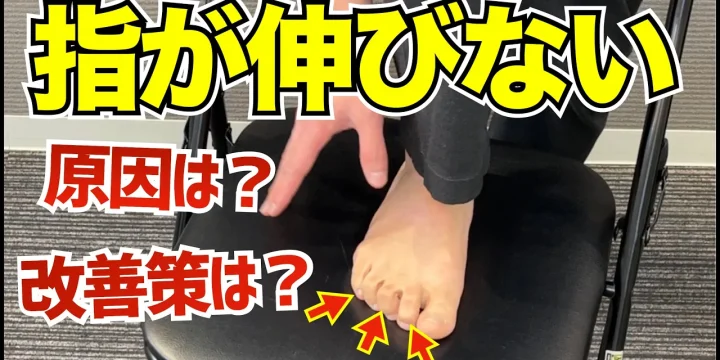 足の指が真っすぐに伸びない。その原因と改善策（マレット趾、ハンマー趾、鉤爪趾）
