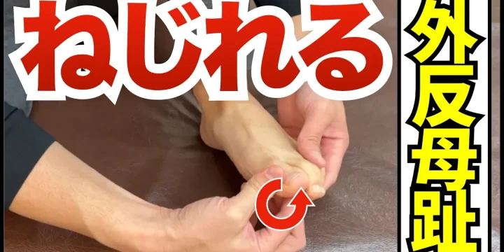 足の親指がねじれる外反母趾の原因とストレッチ方法
