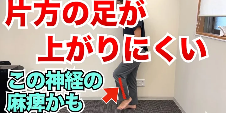 急に足が上がらなくなる、歩きにくくなる「腓骨神経麻痺」とは？　　　