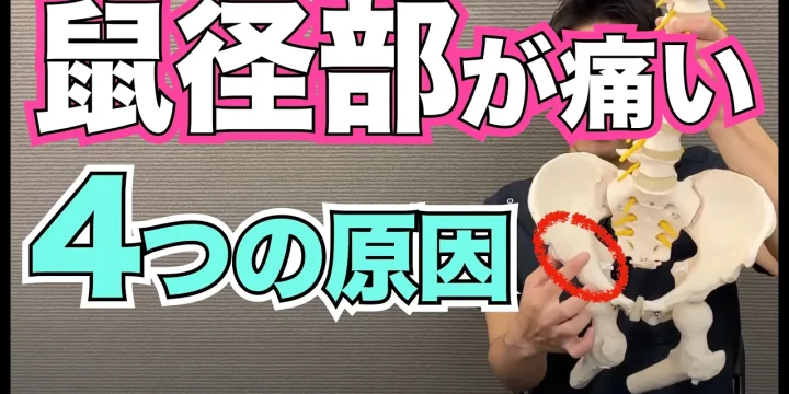 あなたはどのタイプ？鼠径部が痛くなる4つの原因とは？